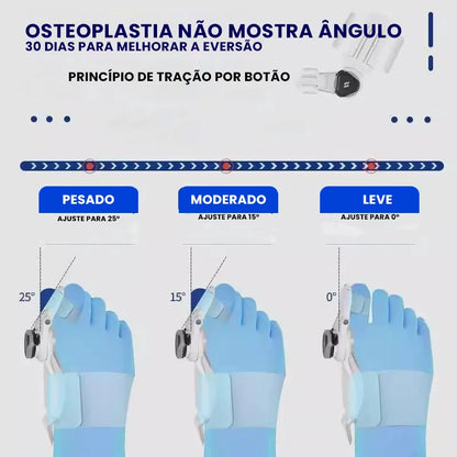 Órtese Ortopédica Ajustável para Joanete com Botão Plus