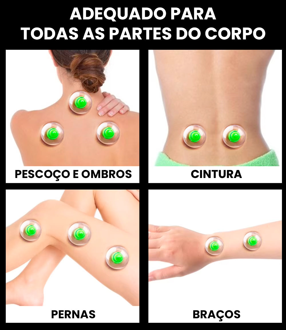 Kit Peças de Ventosaterapia com Pistola de Sucção