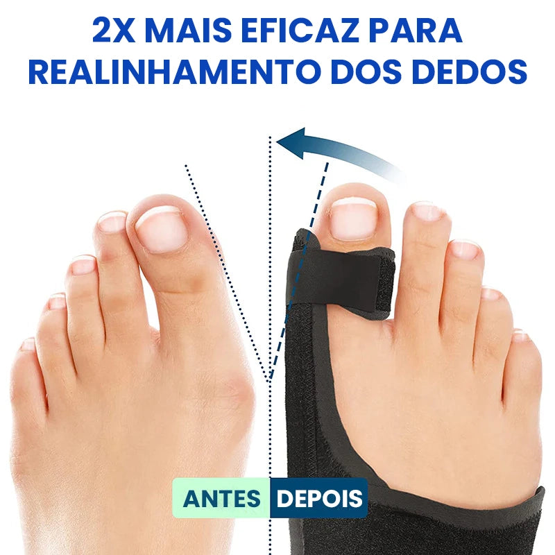 Corretor Ortopédico de Joanete